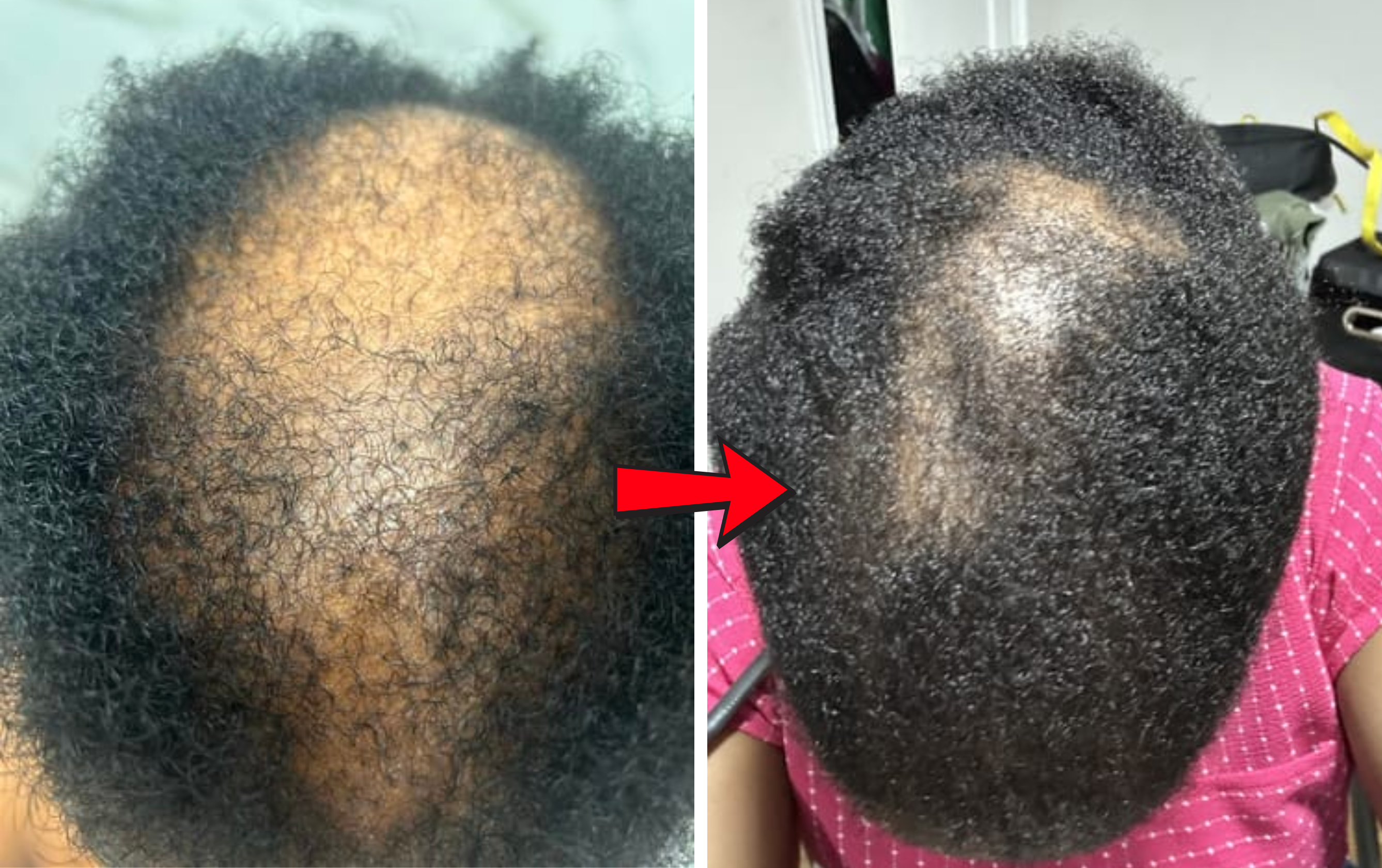 Before and after crown regrowth