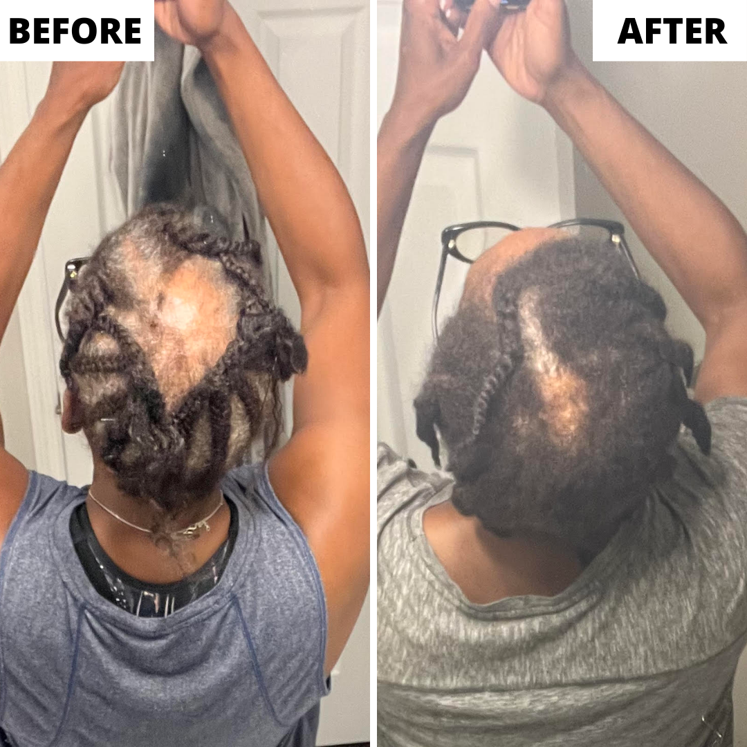 Before and after from above