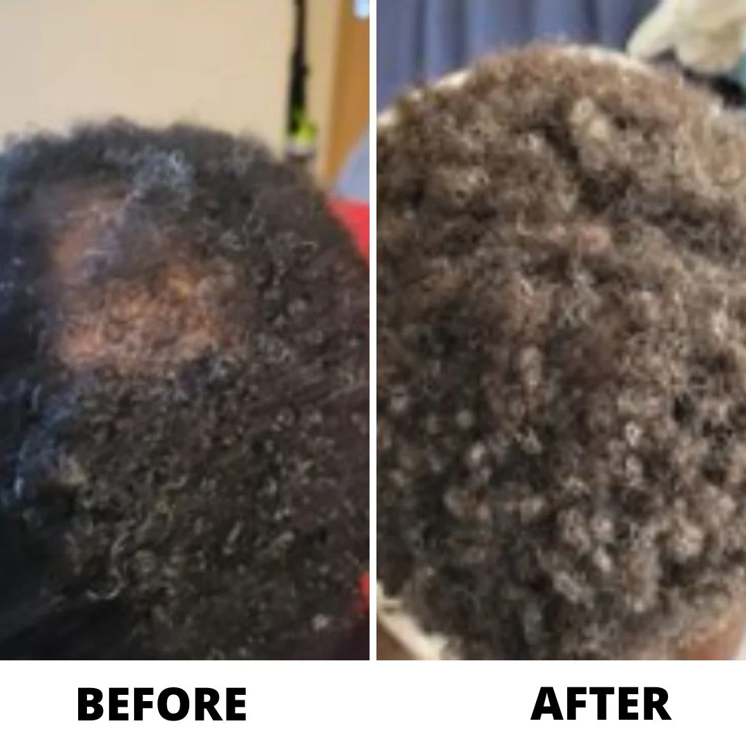 Before and after close-up