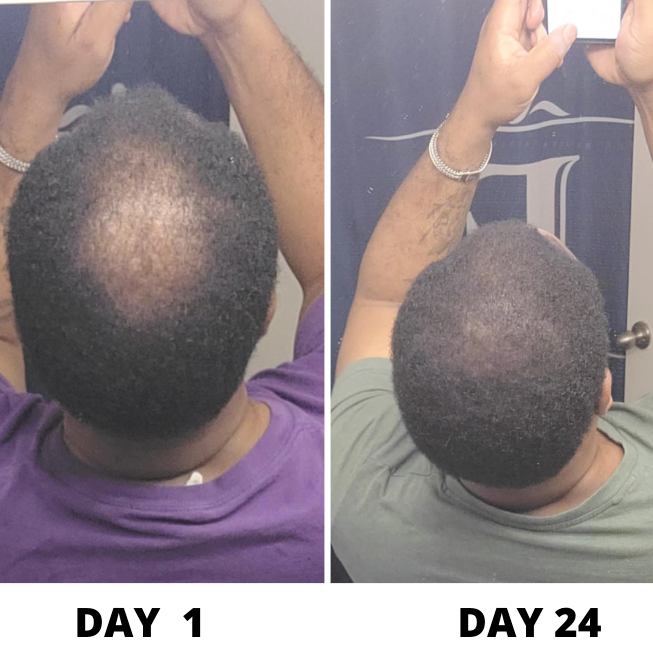 Day 1 vs Day 24 results
